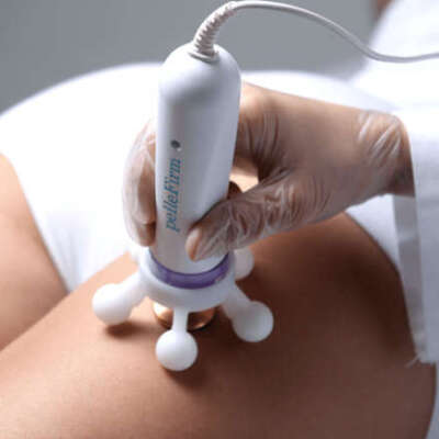 Cellulite Reduction - Package of 3 sessions